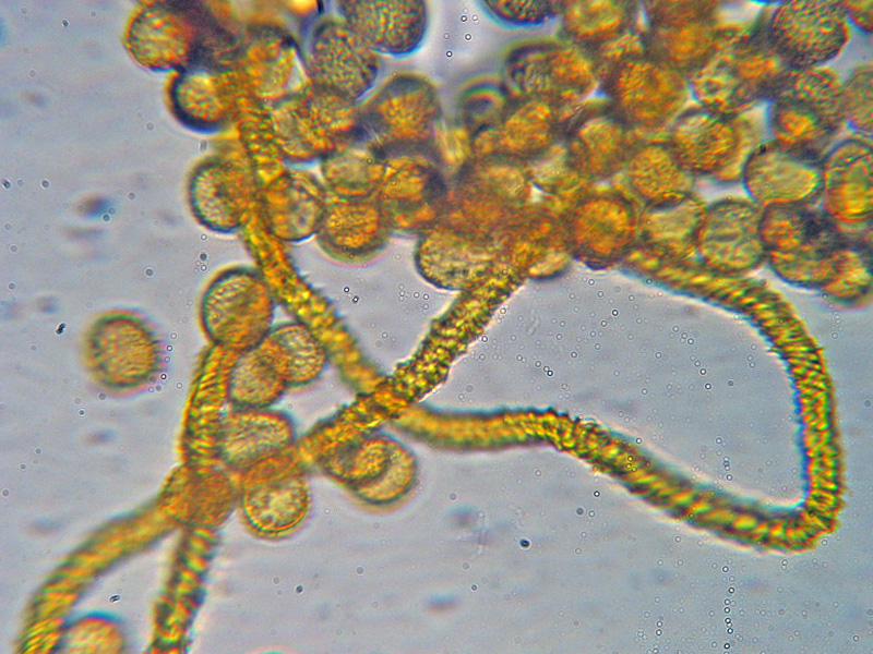 Mixomicete natalizio - Trichia scabra